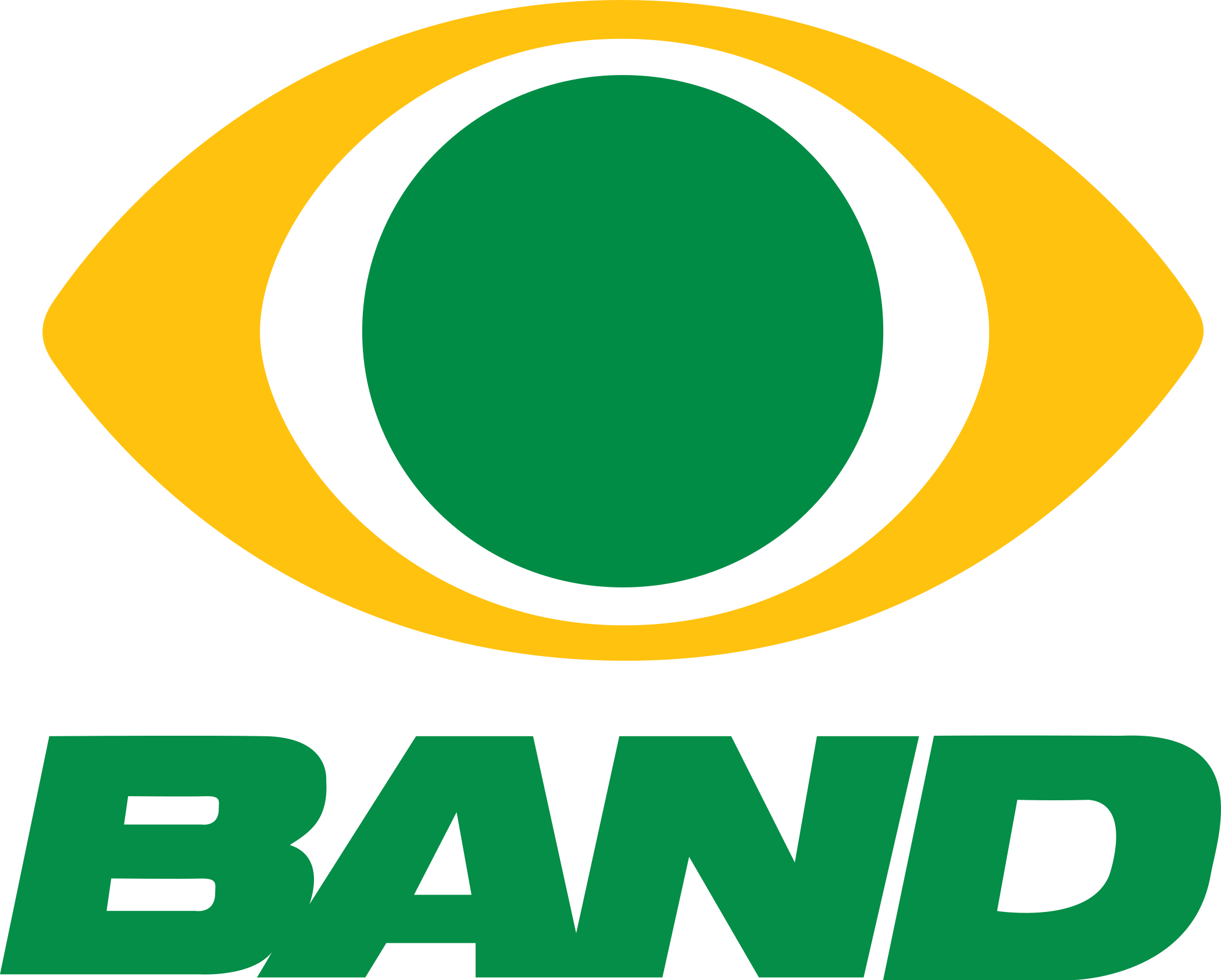 Band - MG